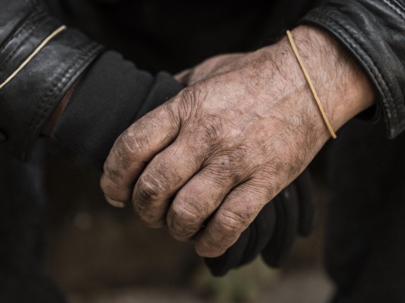 front view of persons weathered hands