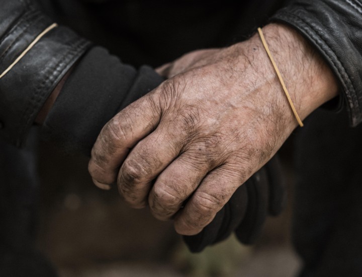 front view of persons weathered hands